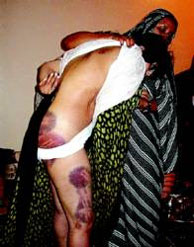 La activista saharaui Leila Lili muestra las heridas que le provoc la polica marroqu. (Foto: elmundo.es)