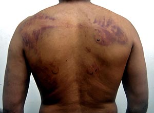 Imagen de un iraqu presuntamente torturado. (Foto: AFP)