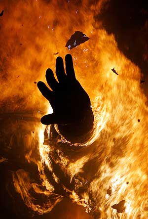 La mano de un nitot de los ms de 700 quemados en las fallas de Valencia. (Foto: EFE)