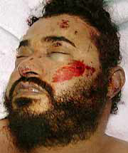 Una foto del cadver de Al Zarqaui. (Foto: AP)