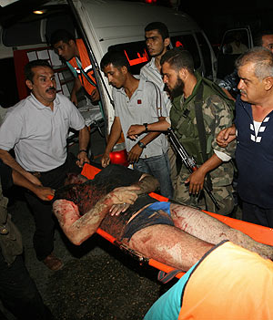 Un palestino herido por un ataque llevado a cabo por el Ejrcito israel en Gaza. (Foto: AFP)