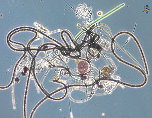 Imagen de una coleccin de microbios marinos. (Foto: EFE)