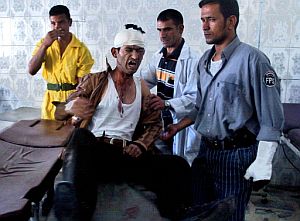 Un iraquí es atendido tras sufrir heridas en un ataque en Irak. (Foto: AP)