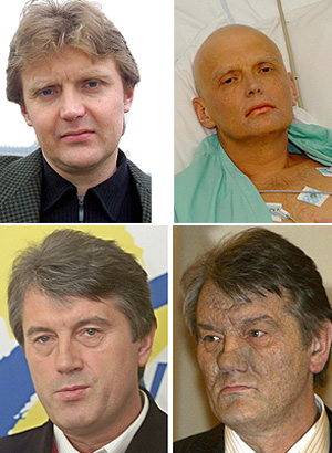 Alexander Litvinenko antes y despus de ser envenenado. Debajo, los estragos del veneno se aprecian en el rostro del presidente de Ucrania, Vctor Yschenko. (Fotos: AP y EFE)