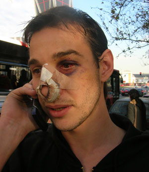 As qued el rostro de Daniel Guill despus de la brutal paliza que le propin la polica. (Foto: elmundo.es)