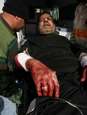 Un peregrino chi herido en uno de los atentados. (Foto: AP)