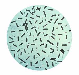 Una bacteria de Clostridium botulinum.