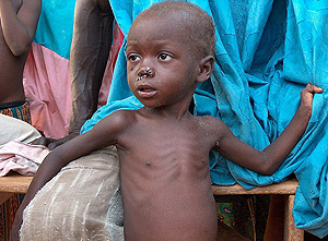 La malnutricin afecta sobretodo a nios. (Foto: Efe)
