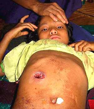 Una niña con una herida de bala. (EFE)