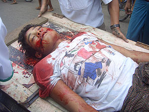 Un manifestante herido es atendido por un compañero en Rangún. (Foto: EFE)