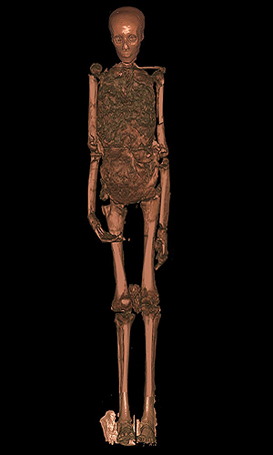 Imagen de escner del esqueleto de la momia de Tutankamn. (Foto: EFE)