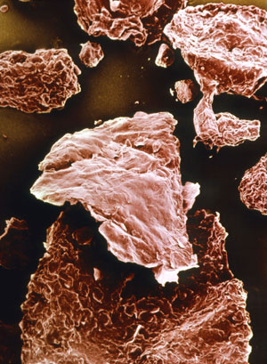 Partcula de caspa vista por el microscopio. (Foto: SPL)