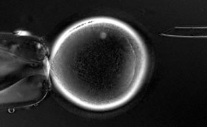 Inserción del núcleo de una célula adulta de macaco en un óvulo de la misma especie. (Foto: Nature)