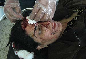 Un mdico atiende a una mujer herida en la explosin. (Foto: AP)