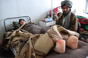 Un joven afgano con los dedos de los pies amputados por congelacin, en el hospital de Herat. (Foto: M. Bernab)