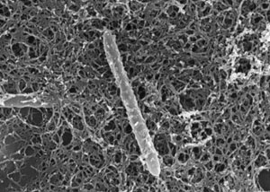 Micrografía de la bacteria 'Desulforudis audaxviator' encontrada en la mina de Mponeng, Sudáfrica. (Foto: 'Science').