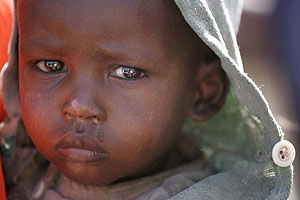 Un niño etíope malnutrido espera ser atendido en una clínica de Médicos Sin Fronteras. (Foto: EFE)