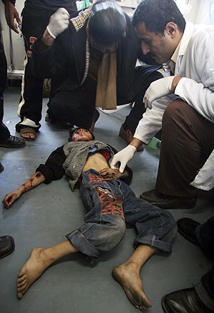 Mdicos palestinos examinan el cadver de un nio en el hospital de Shifa. (Foto: AP)