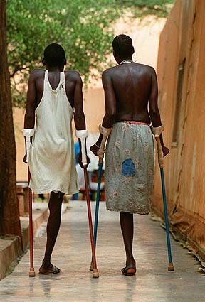 Dos mujeres con una pierna amputada que pierdieron en la guerra de Sudn. (Foto: Eric Feferberg)