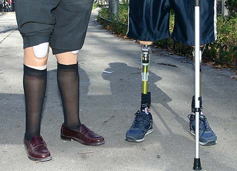 Dos personas con prtesis en sus dos piernas. (Foto: Diego Sinova)