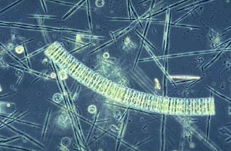 Fotografa microscpica que muestra un grupo de fitoplancton tres semanas despus de su fertilizacin con hierro en el barco de investigacin 'Polarstern'. (Foto. EFE)