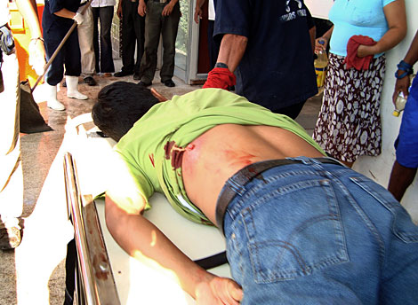 Indígena con un disparo en la espalda en el hospital de Bagua. | AFP