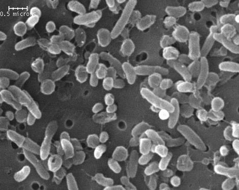 Imagen de una colonia de la bacteria diminuta 'Herminiimonas glaciei'. | Society for General Microbiology