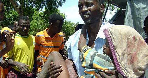 Un somal con su hijo herido en Mogadiscio.| AP