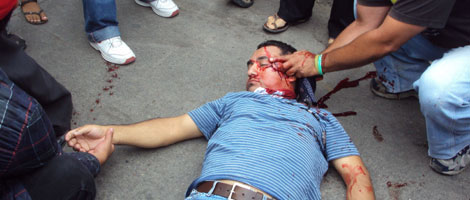 Un maestro herido en la cabeza durante una manifestacin en Tegucigalpa. | AFP