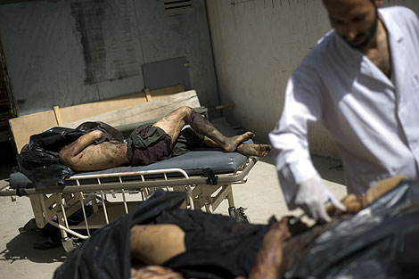 Dos de los heridos en el atentado. | AFP