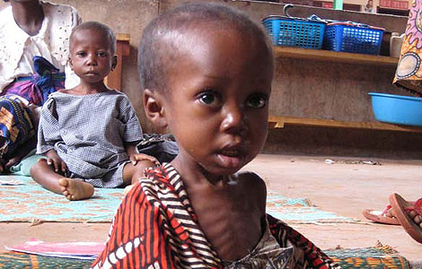 Nios centroafricanos gravemente desnutridos. | Accin contra el Hambre