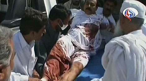 Un hombre herido durante la explosin. | AFP/Al-Alam TV