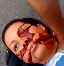 Neda, tras ser tiroteada en Tehern. | Efe