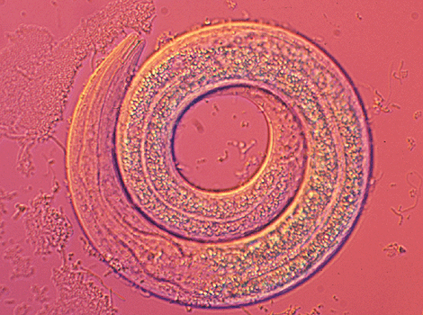 imagen de un 'Caenorhadbitis elegans'. | Nature.