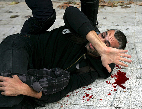 Uno de los manifestantes herido durante las protestas. | Efe