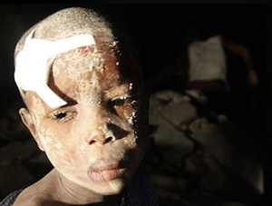 Un niño herido espera atención médica en Puerto Príncipe. | Reuters