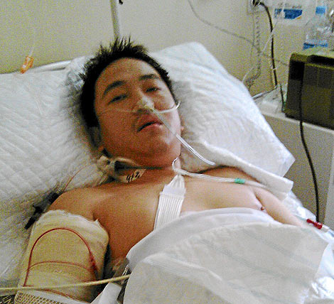 Luis se recupera de las heridas sufridas en el hospital La Fe | E.M.