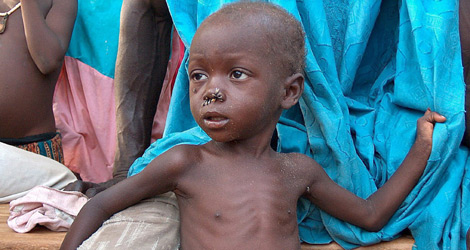 Un nio muestra sntomas de malnutricin en Nger. | Efe