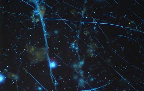Bacterioplankton marino, similar al lacustre bajo el microscopio, pero en realidad muy diferente. | L. Alonso | CSIC