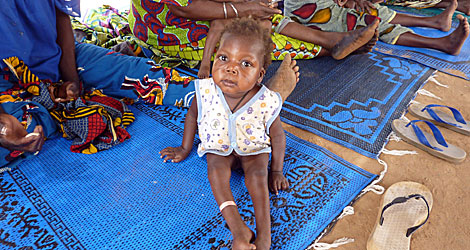 Una nia que sufre malnutricin y malaria en Nigeria. | Afp