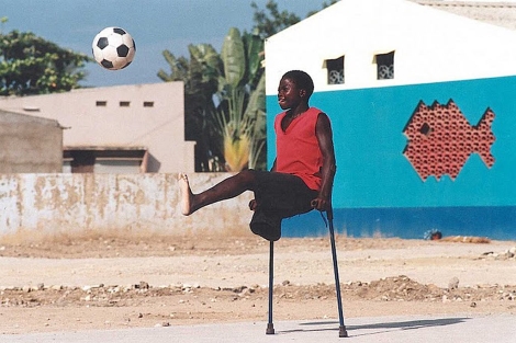 Un nio con una pierna amputada por una bomba en Angola. | CMC