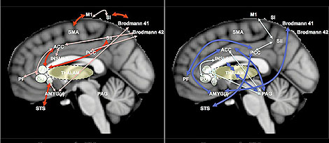 Cerebros en estado de reposo de una persona con dolor crnico (izquierda) y de otra sana