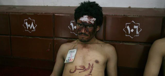 Uno de los heridos en San. | Afp