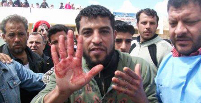Un manifestante muestra su mano ensangrentada en un funeral en Izraa. | AP MS FOTOS