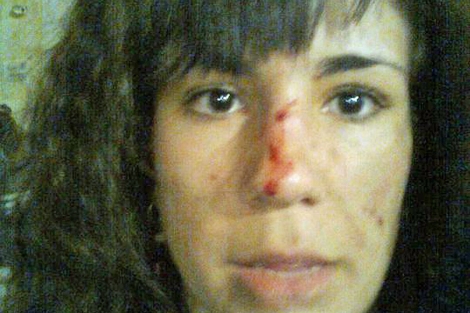 Una de las indignadas muestra las heridas tras la carga. | Facebook