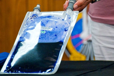 Una imagen de la bolsa que recicla fluidos corporales.| NASA