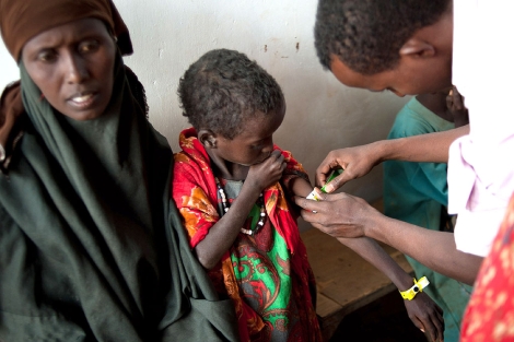 Un nio somal es sometido a la prueba de la malnutricin en el campamento en Dadaab, Kenia. |