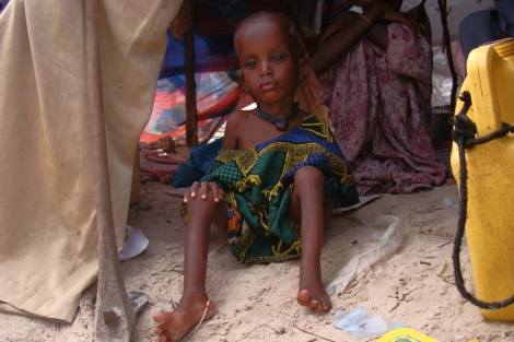 Un nio somal desnutrido sentado en su tienda en un campo de Mogadiscio.| AFP