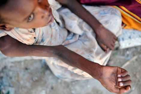 Una joven espera recibir atencin en Mogadiscio.| Efe