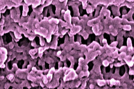 Imagen ampliada de material nanoporoso.